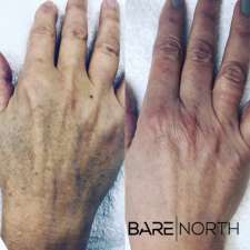 BARE North | 1055 Fanshawe Park Rd W Suite 304, London, ON N6G 5B4, Canada