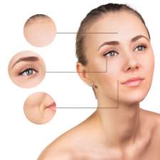 Bella Laser and Skin Care | 72 Bloomsbury Ave, Brampton, ON L6P 1S6, Canada