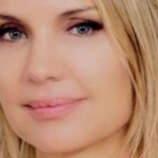 Louisa Street Laser & Medical Esthetics Botox & Juvederm | 48 Louisa Street West Near, Elma St S, Thornbury, ON N0H 2P0, Canada