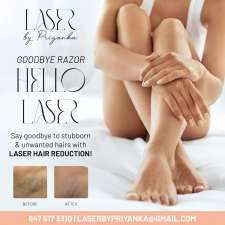 Laser By Priyanka | 16 Dowden Ave, Brantford, ON N2T 6N6, Canada