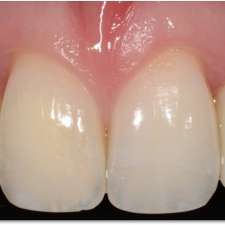 Dr Philippe Girard Prosthodontiste | 1145 Boulevard Lebourgneuf #100, Québec, QC G2K 2K8, Canada
