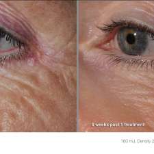 Profile Medical Cosmetics | 1415 1st Ave W Suite #3004, Owen Sound, ON N4K 4K8, Canada