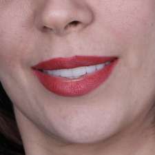 Newtonbrook Dental | 139 Finch Ave W, North York, ON M2N 2J1, Canada