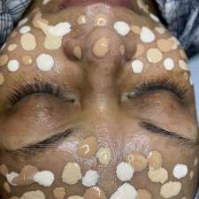 NR Laser & Spa | 7088 Justine Dr, Mississauga, ON L4T 1M3, Canada