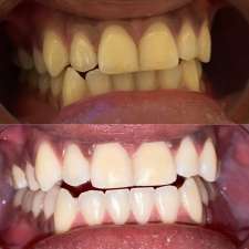 Blanche Smiles | 274 Markham Rd, Scarborough, ON M1J 3C5, Canada