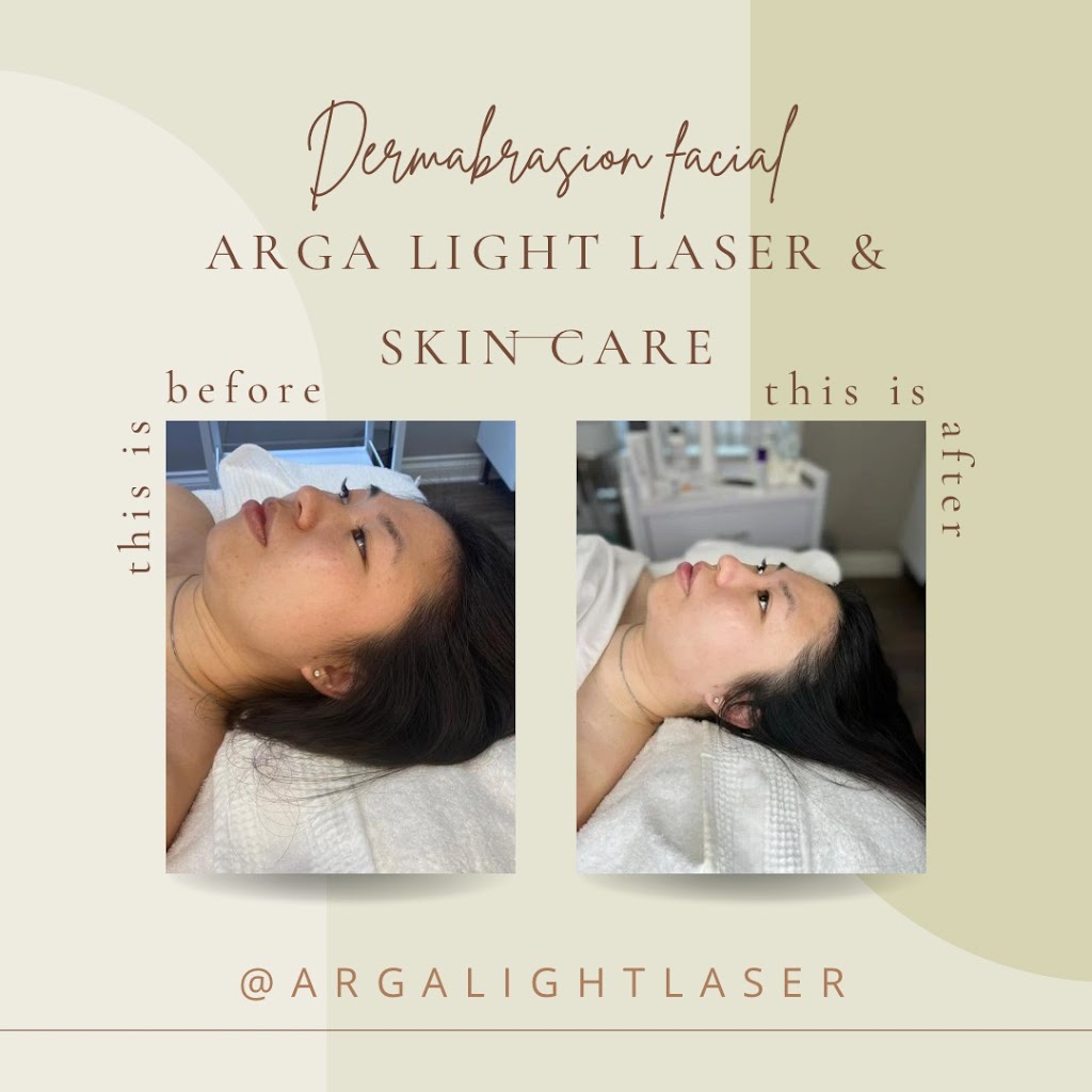 Arga Light Laser& Skin Care | 3059 Timber Ct, Coquitlam, BC V3E 2Y8, Canada | Phone: (604) 838-8445