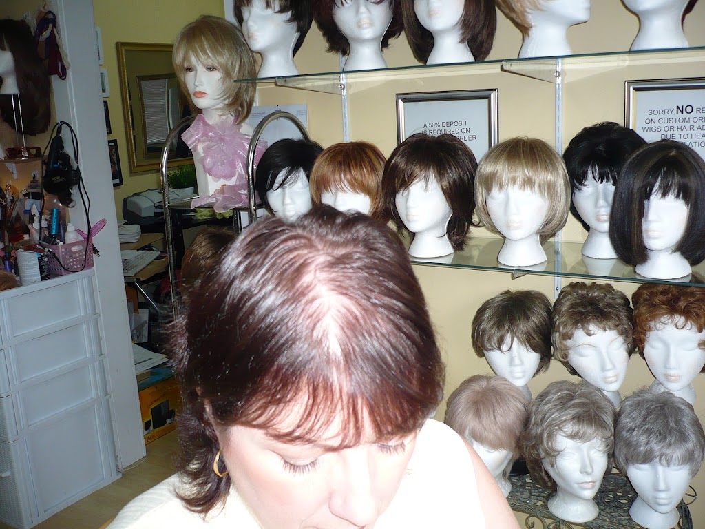 Real Hair Loss Solutions | 321 Lynn Ave, North Vancouver, BC V7J 2C4, Canada | Phone: (604) 980-3211