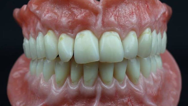 PADUA DENTAL ARTS Denture Clinic & Dental Laboratory - Whitby | 1121 Dundas St E, Whitby, ON L1N 2K4, Canada | Phone: (905) 493-9004