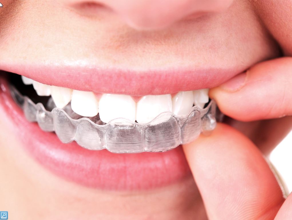 Saban Dental Office | 325 Burnhamthorpe Rd, Etobicoke, ON M9B 2A2, Canada | Phone: (416) 236-0009