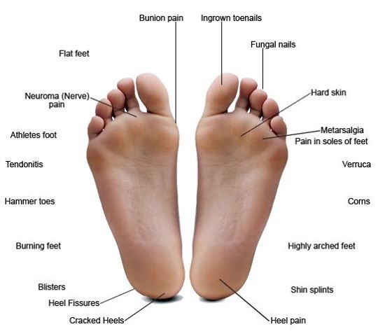 inStep Footcare Services | 2 Valleycrest Ave, Markham, ON L3P 1H7, Canada | Phone: (416) 294-7880