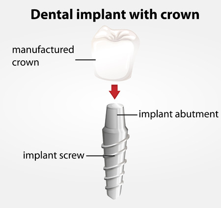 Dr. Davidson’s Dental Office | 1450 Centre St #2, Thornhill, ON L4J 3N1, Canada | Phone: (905) 707-8644