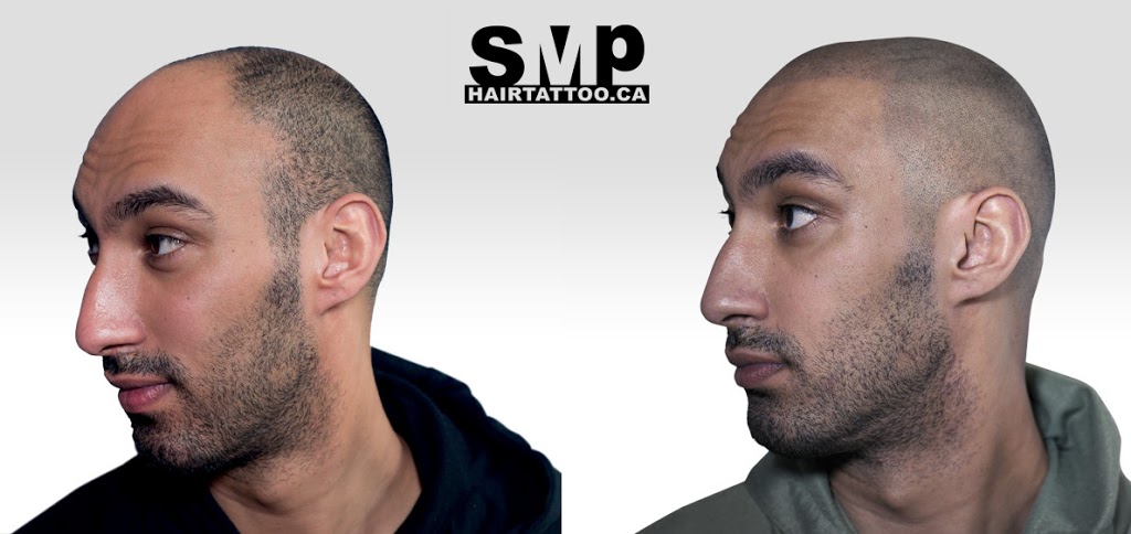 SMP® Scalp Micropigmentation Richmond Hill | HAIRTATTOO.CA | 9140 Leslie St #301, Richmond Hill, ON L4B 3L6, Canada | Phone: (647) 492-9093