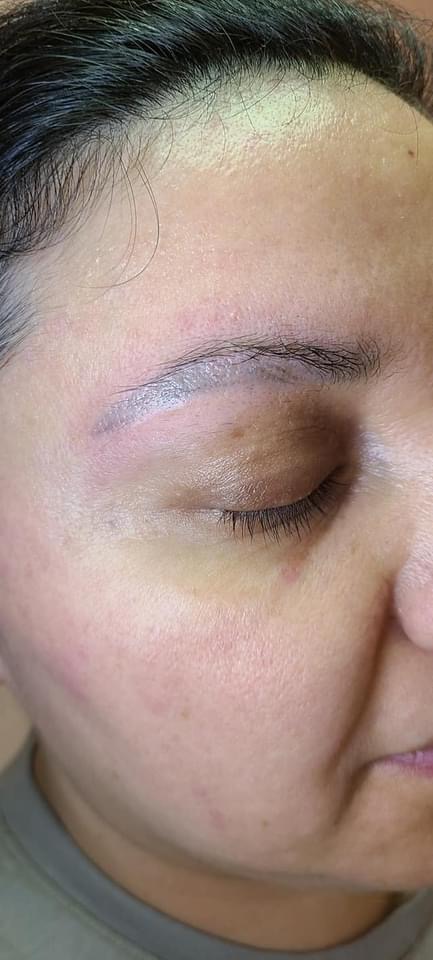 Emergency Removal - Eyebrow Tattoo Removal | 11675 Seventh Ave, Richmond, BC V7E 4X4, Canada | Phone: (672) 514-1790