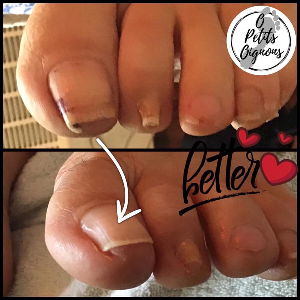 soins des pieds O petits oignons | 49 Rue du Hauban, Oka, QC J0N 1E0, Canada | Phone: (514) 627-8408