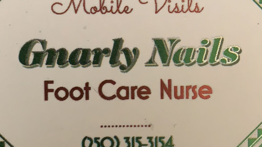 Gnarly Nails Footcare Nurse | 1551 Bann St, Merritt, BC V1K 1P7, Canada | Phone: (250) 315-3154