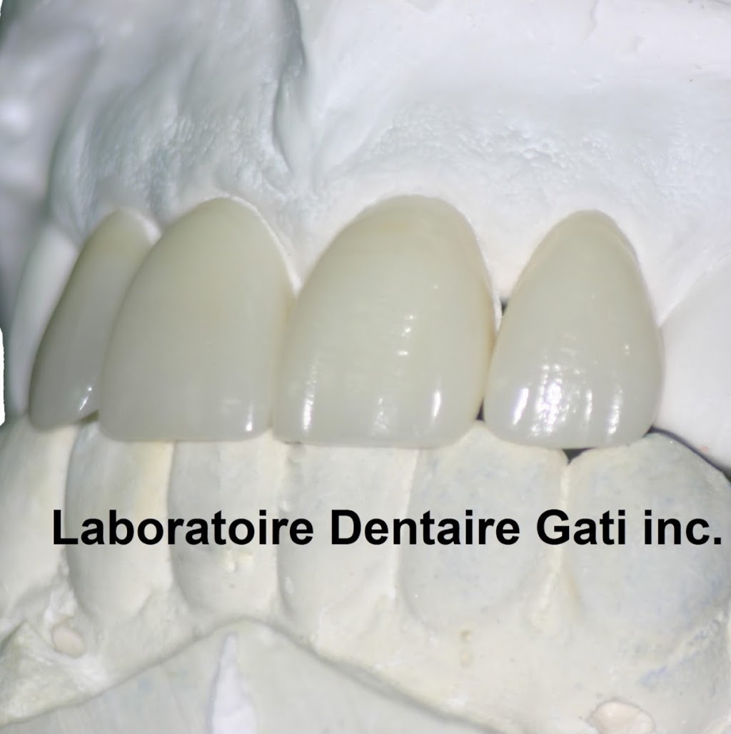 Laboratoire Dentaire Gati inc. | 20 Rue des Sables, Sorel-Tracy, QC J3P 5E6, Canada | Phone: (450) 742-6316