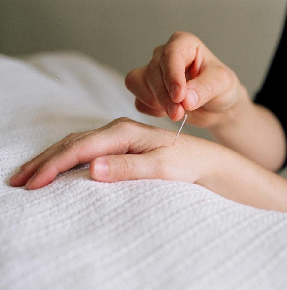 Acupuncture Julie Rochon | 3121 Rue Saint Luc, Rawdon, QC J0K 1S0, Canada | Phone: (514) 688-8885