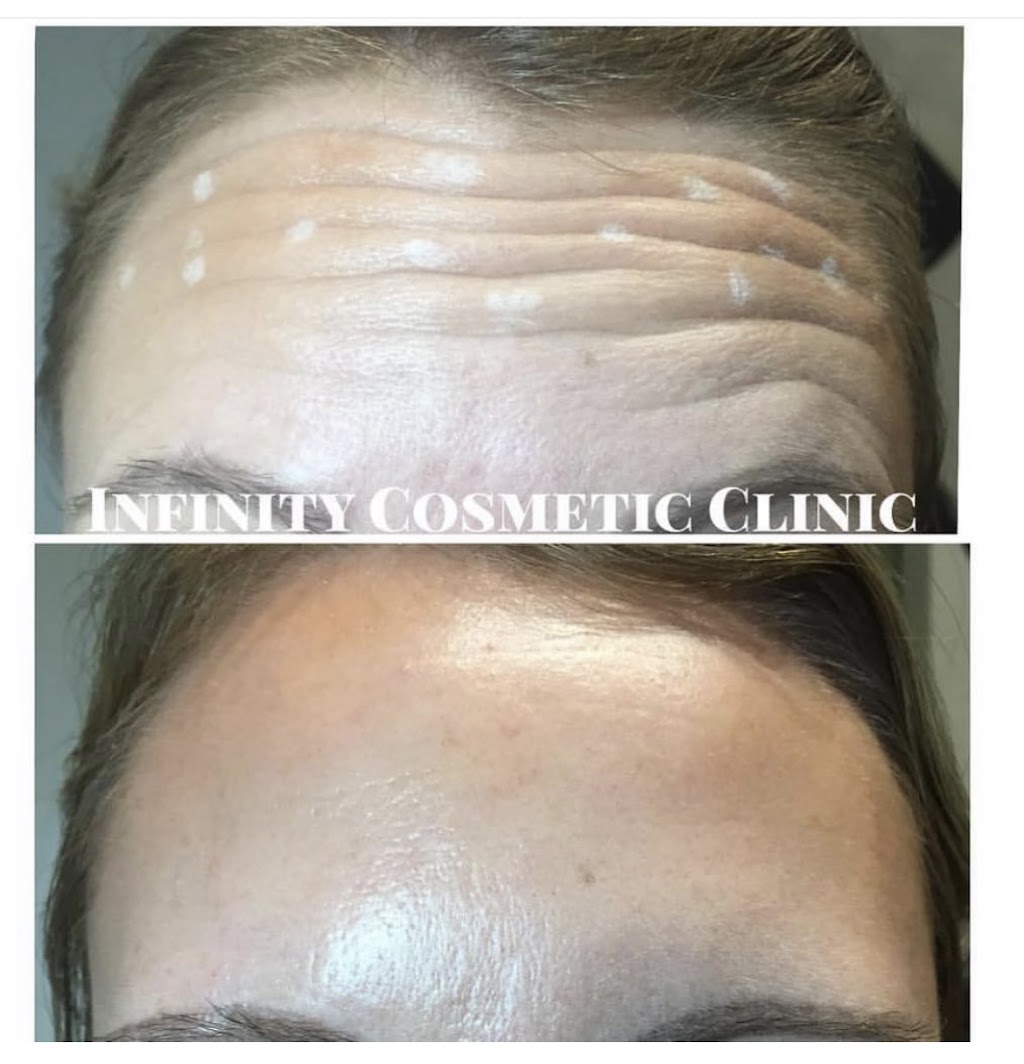 Infinity Cosmetic Clinic | 180 Pinebush Rd, Cambridge, ON N1R 7H8, Canada | Phone: (519) 740-7555