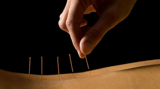 Acupuncture Magda Beaudry | 705 Rue Taschereau, Sainte-Thérèse, QC J7E 4C9, Canada | Phone: (450) 951-2136