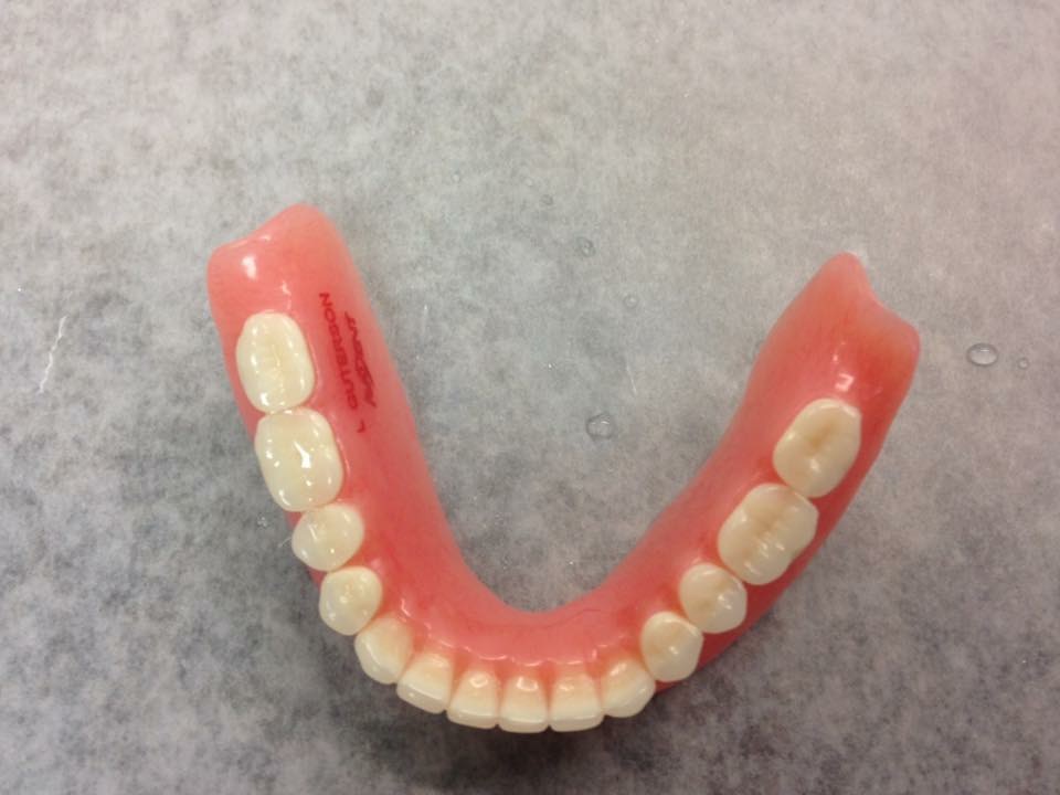 Radiant Smiles Denture | 5105 149A St NW, Edmonton, AB T6H 4W2, Canada | Phone: (780) 616-2641