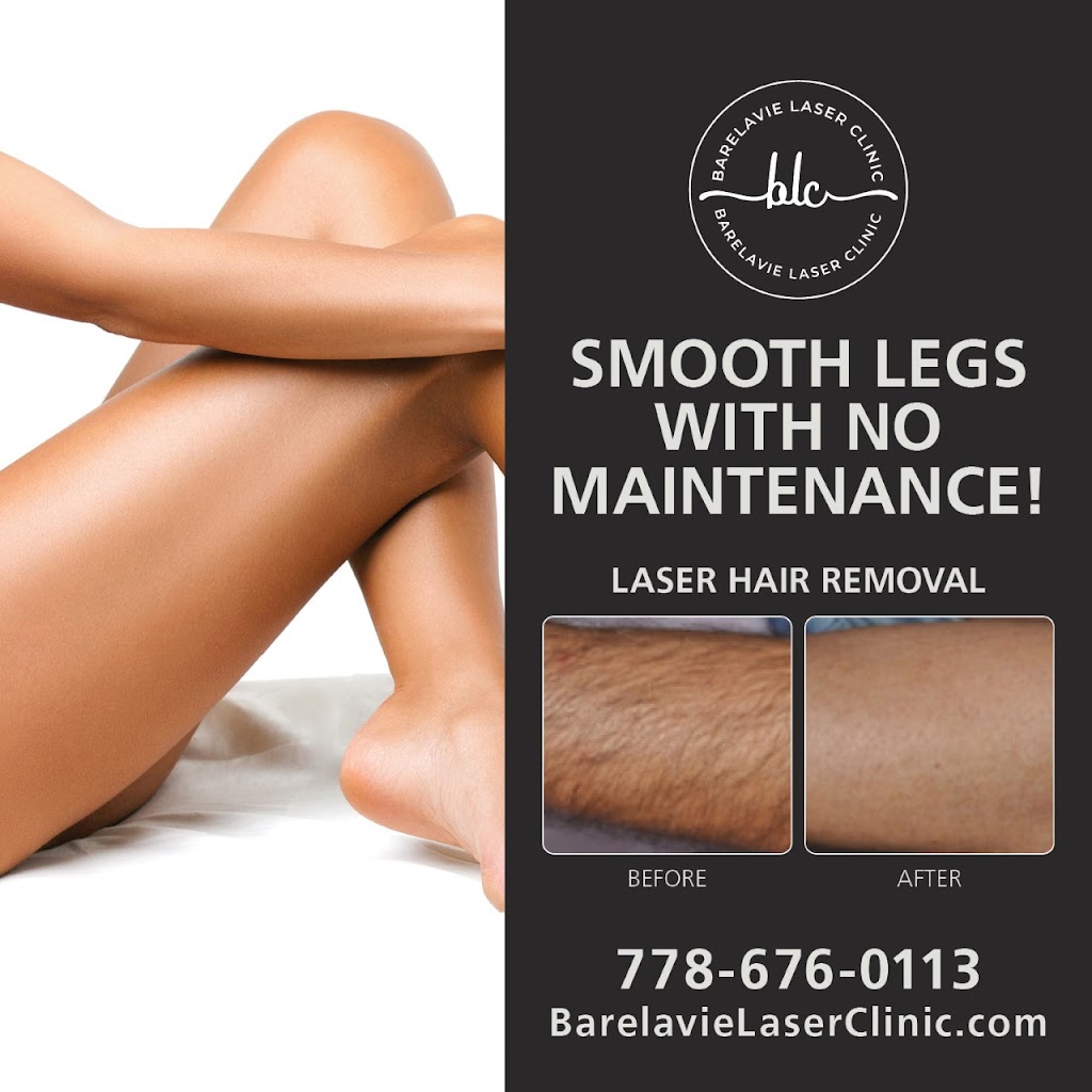 Barelavie Laser Clinic | 472 Regency Pl, Victoria, BC V9C 0J7, Canada | Phone: (778) 676-0113