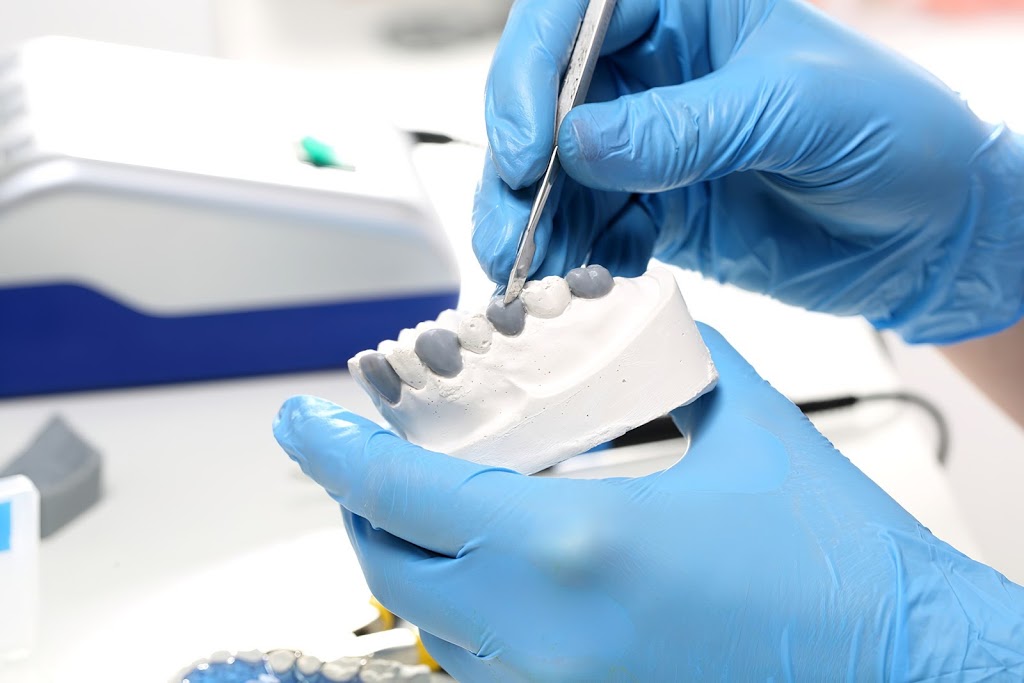 VoyDent Dental Laboratory | 1261 A St Clair Ave W, Toronto, ON M6E 1B8, Canada | Phone: (647) 717-3133