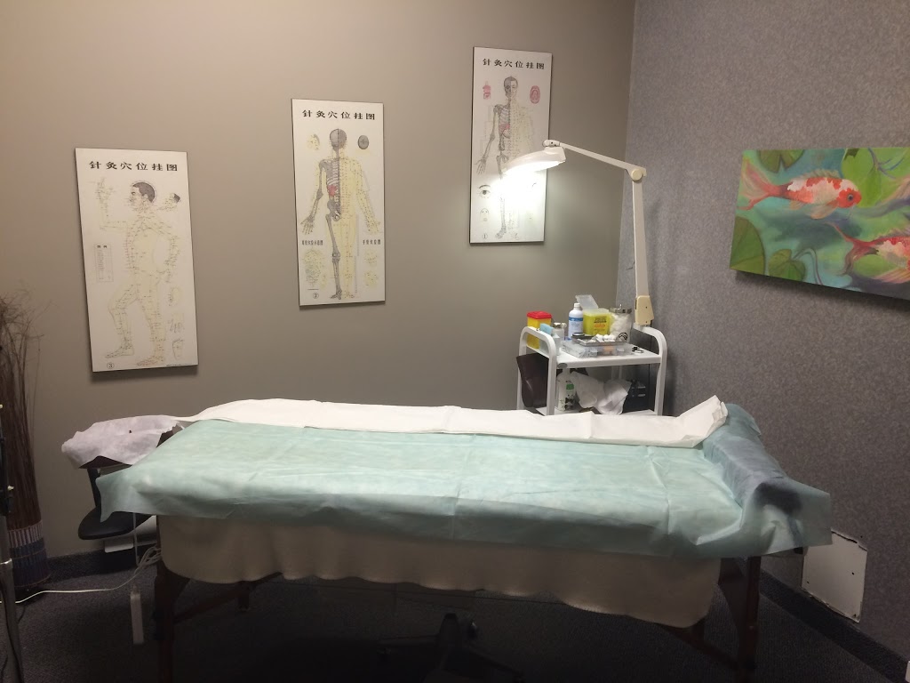 acupuncture Châteauguay | 185 Boulevard Saint-Jean-Baptiste suite 401, Châteauguay, QC J6K 3B4, Canada | Phone: (514) 913-2977