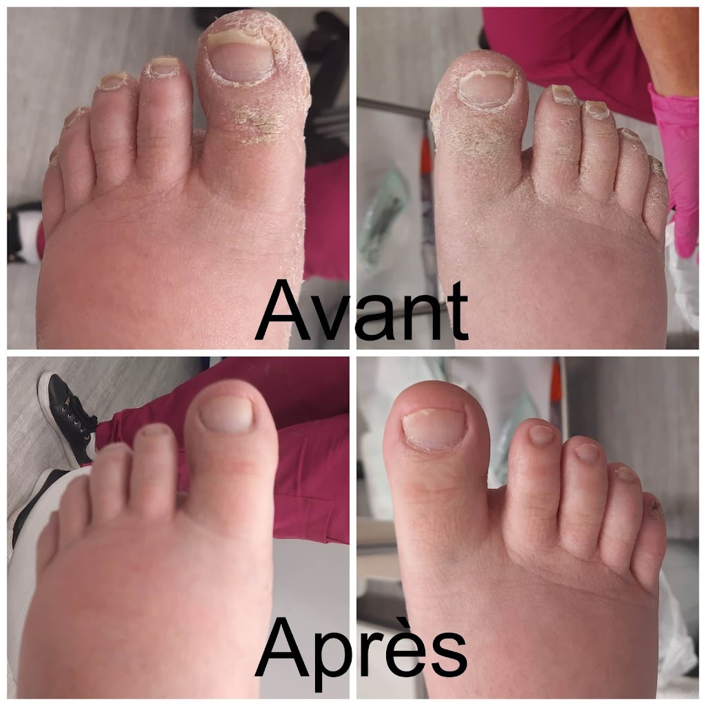 SMJ PODOLOGIE Soins de pieds à domicile | 359A Rang de la Rivière Sud-Ouest, Maskinongé, QC J0K 1N0, Canada | Phone: (514) 318-2050