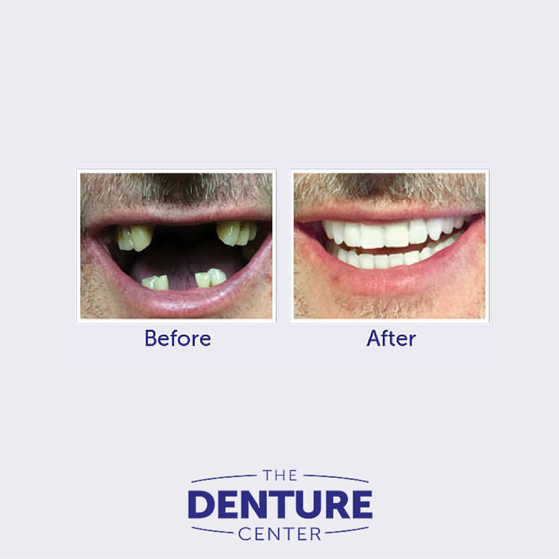 The Denture Center | 2892 S Sheridan Way, Oakville, ON L6J 7L4, Canada | Phone: (905) 829-1033