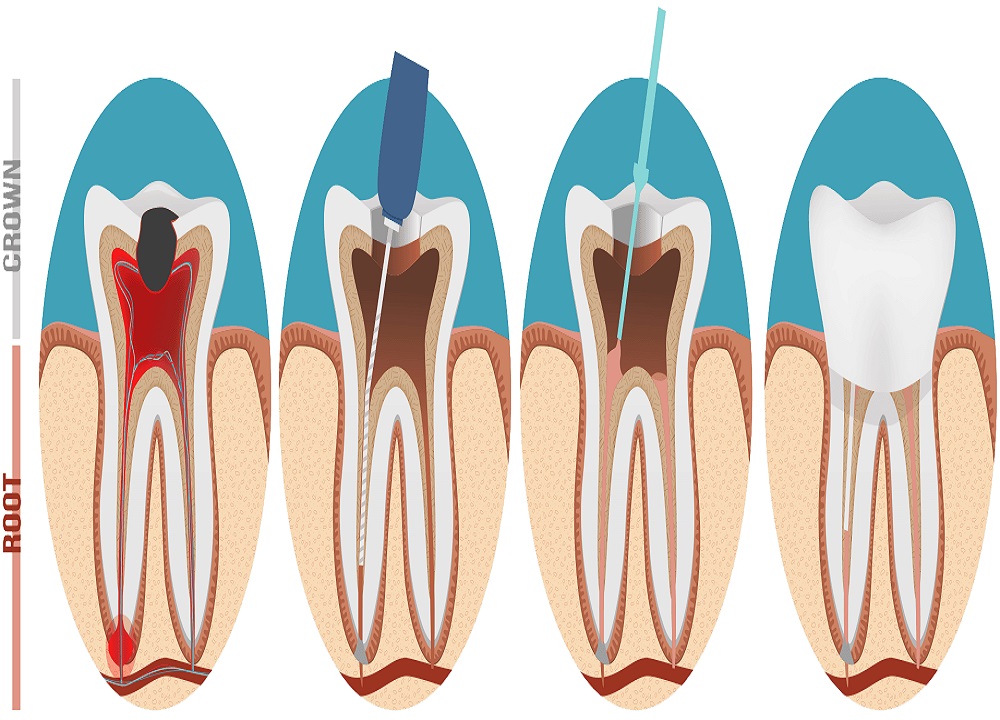 My Dental Home, Dr. Kevin Brown & Associates | 5011 Hwy 7, Unionville, ON L3R 1N1, Canada | Phone: (905) 415-7700