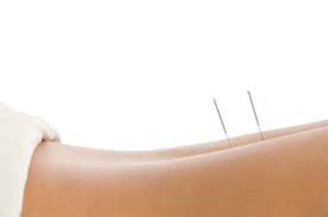 Caroline Lussier Acupuncteure | 6165 Boulevard Laframboise #101, Saint-Hyacinthe, QC J2R 1G2, Canada | Phone: (450) 796-1212