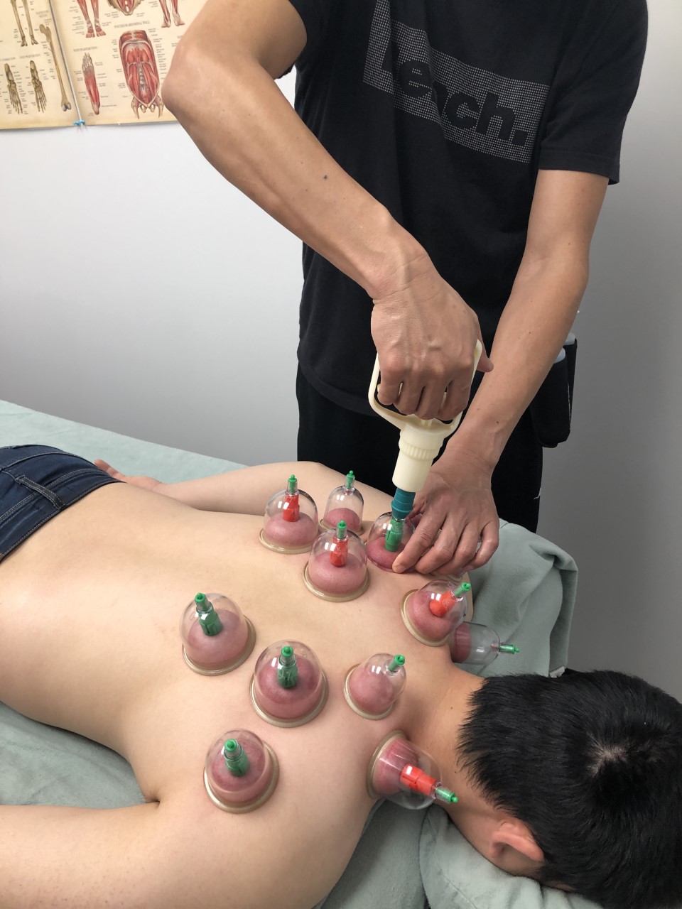 TruRelief Wellness Massage & Acupuncture | 108 Shawville Pl SE Unit 130, Calgary, AB T2Y 0V2, Canada | Phone: (587) 718-7768