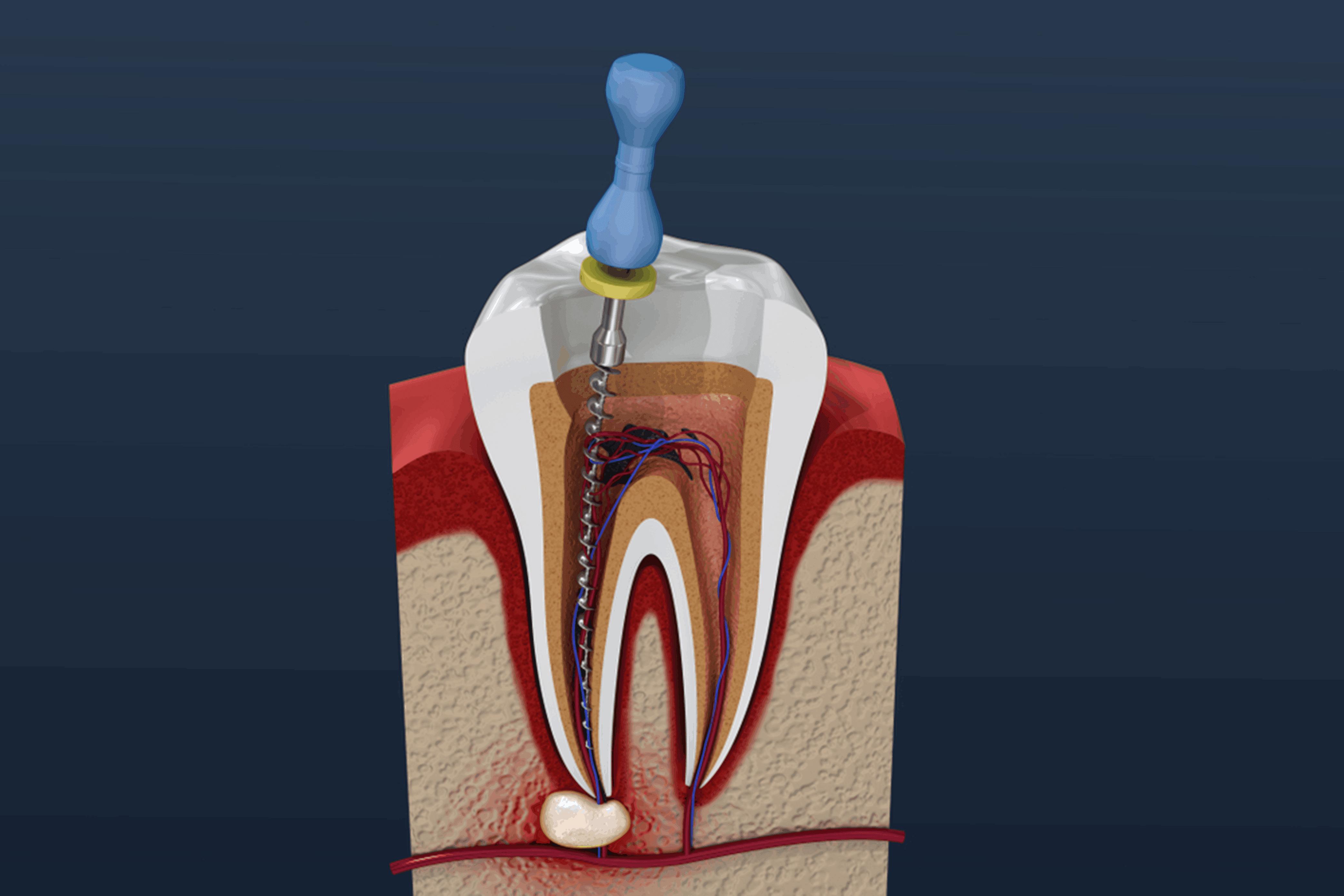 South Trail Crossing Dental | 4307 130 Ave SE #57, Calgary, AB T2Z 3V8, Canada | Phone: (403) 720-2778