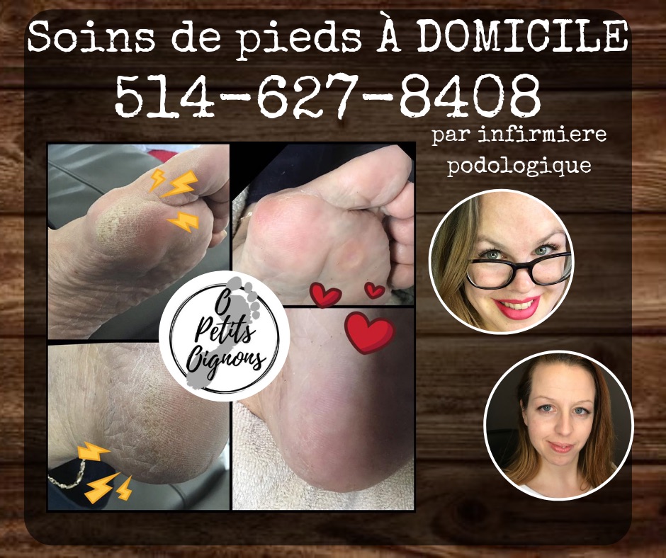 soins des pieds O petits oignons | 49 Rue du Hauban, Oka, QC J0N 1E0, Canada | Phone: (514) 627-8408