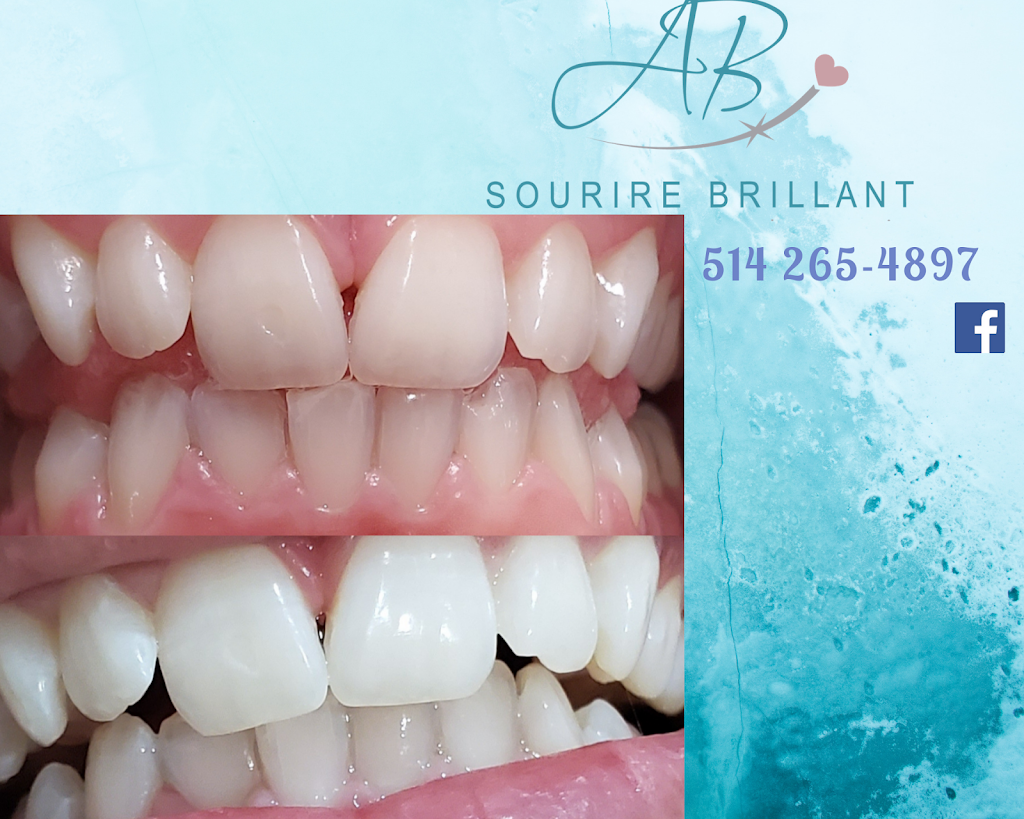 A.B. Sourire Brillant | 4600 Boulevard Sainte-Rose, Laval, QC H7R 1Z2, Canada | Phone: (514) 265-4897