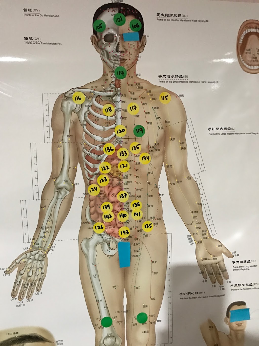 Holistic Hijama Benefits | 3915 Baggins Ct, Mississauga, ON L5N 7A3, Canada | Phone: (416) 388-5036