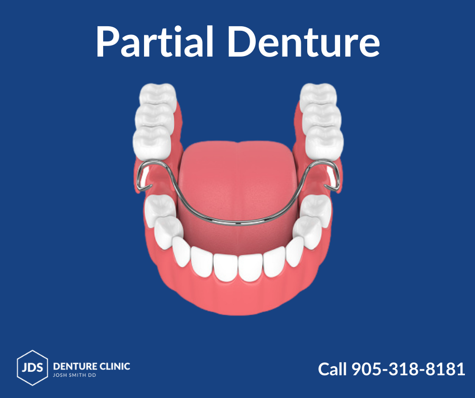 J. D. S. Denture Clinic | 552 Upper James St, Hamilton, ON L9C 2Y4, Canada | Phone: (905) 318-8181