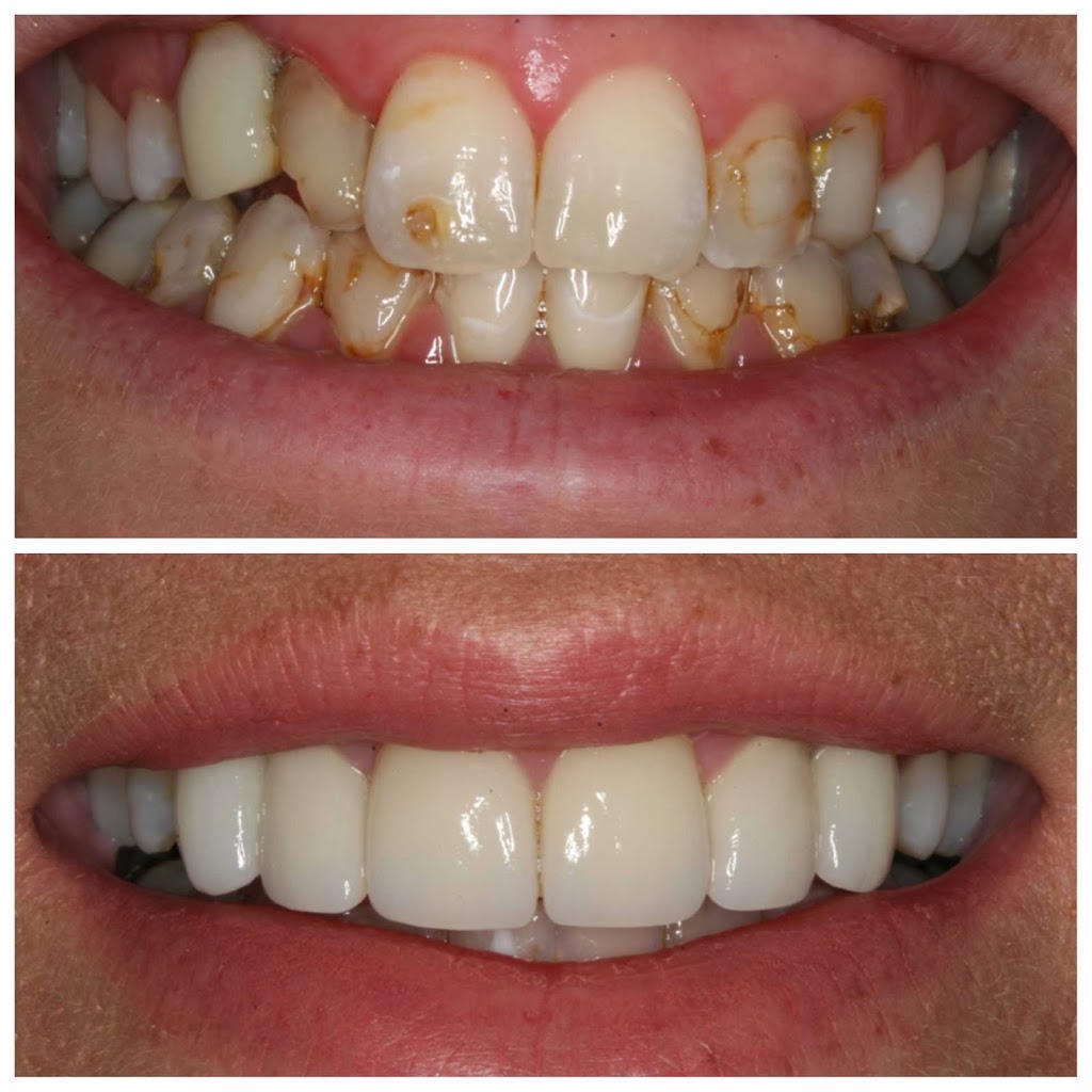 Dr. Andrea Stevens Dentistry | 350 Palladium Dr, Kanata, ON K2V 1A8, Canada | Phone: (613) 271-7091