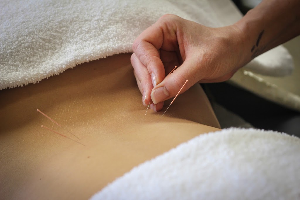 The Acupuncture And Health Centre | 12427 Bonaventure Dr SE #202, Calgary, AB T2J 3N8, Canada | Phone: (403) 253-3103