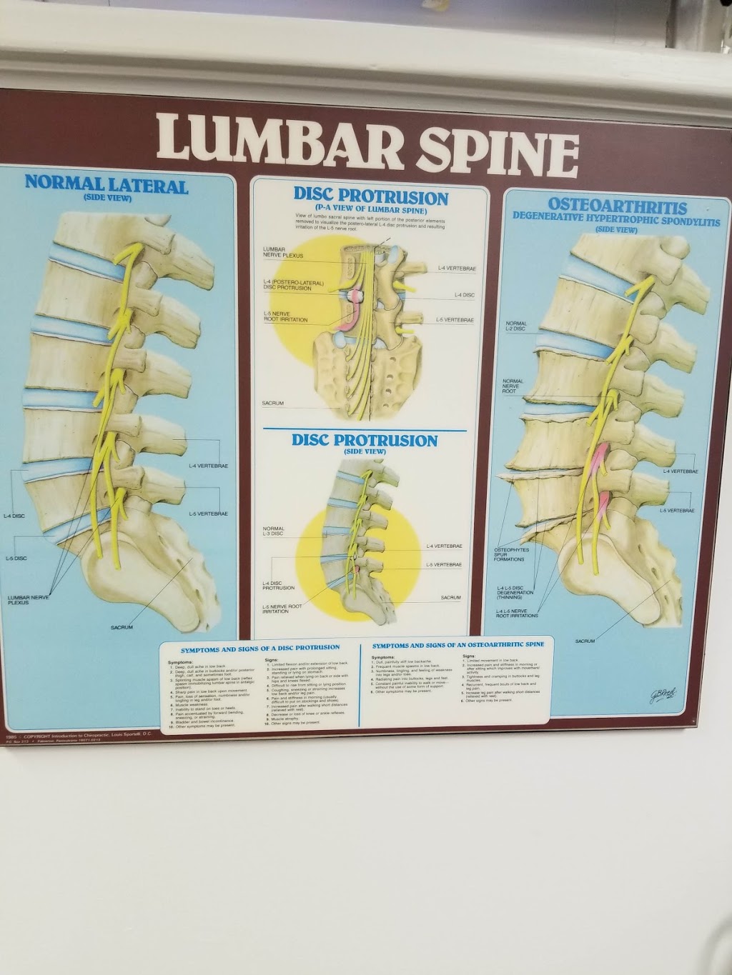 Koch & Associates Spine Centre | 866 Main St E, Hamilton, ON L8M 1L9, Canada | Phone: (905) 544-5688