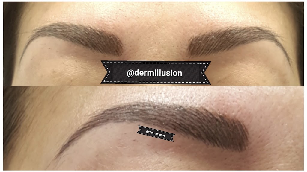 DERMILLUSION Permanent Cosmetics | 6608 111 Ave NW, Edmonton, AB T5B 0A6, Canada | Phone: (587) 400-0011