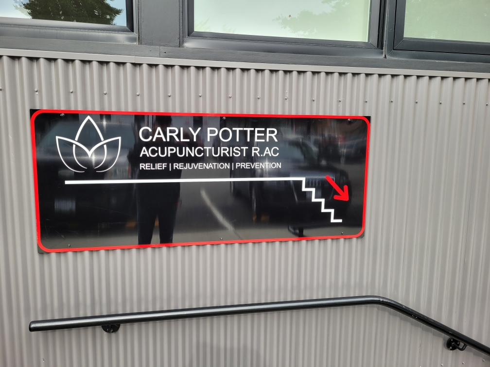 Carly Potter Acupuncture | 3855 9th Ave, Port Alberni, BC V9Y 4T9, Canada | Phone: (250) 735-7668