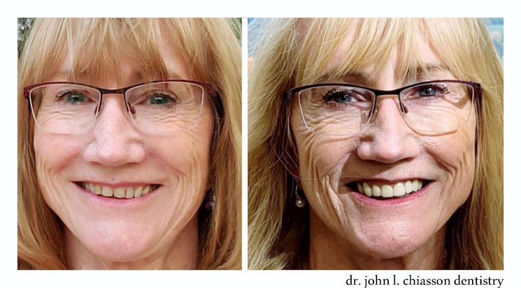 Dr John L. Chiasson Dentistry | 1470 Mosley St, Wasaga Beach, ON L9Z 2C2, Canada | Phone: (705) 352-1028