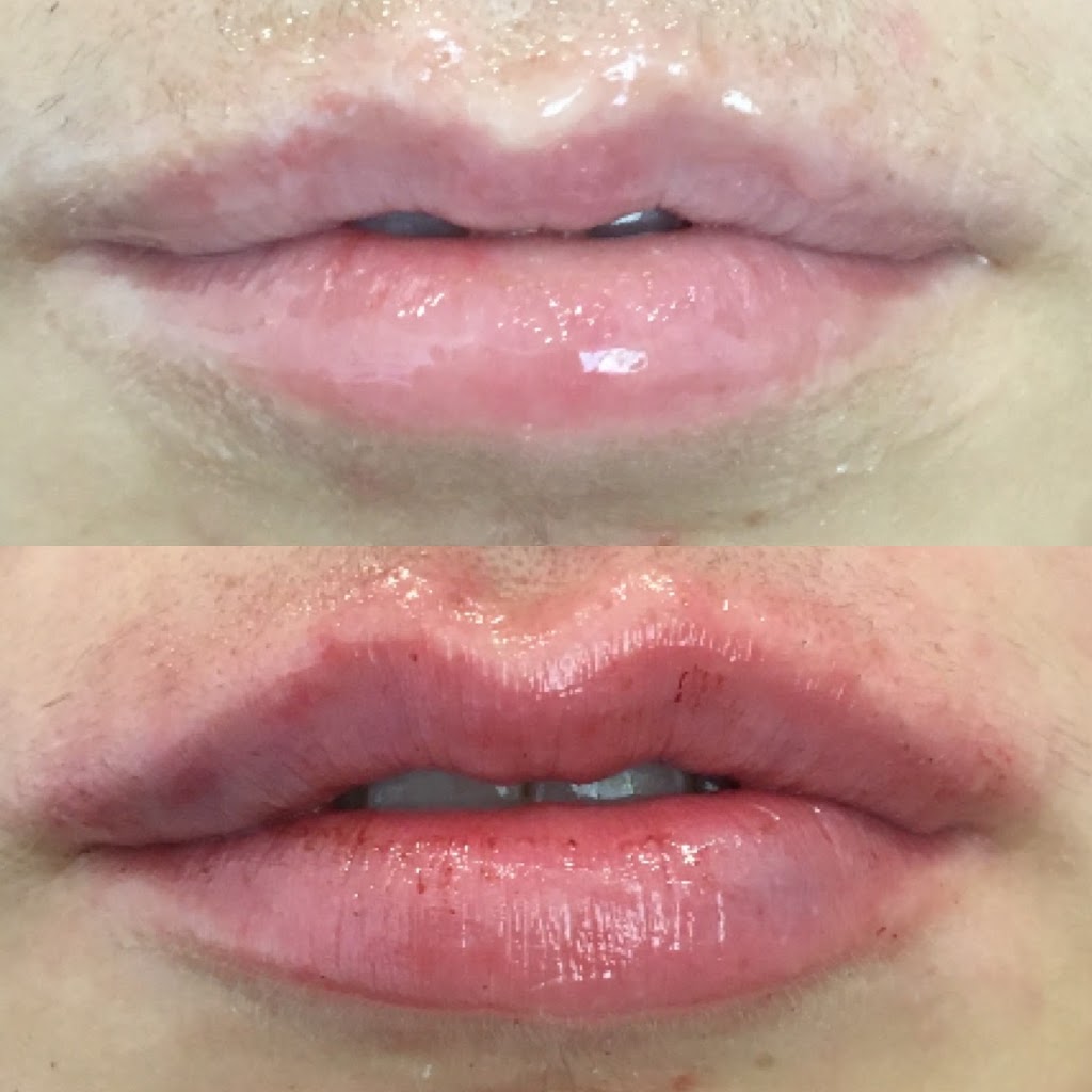 Lips and Lines by Lil | 380 Moloney Line, Ennismore, ON K0L 1T0, Canada | Phone: (705) 868-7529