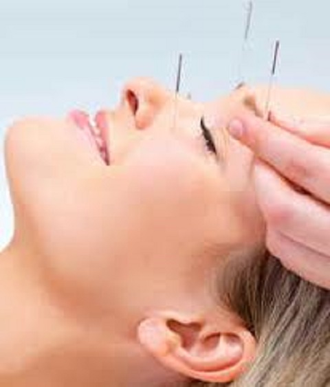 Acupuncture Rive-Nord | 15 Rue des Perdrix, Blainville, QC J7C 4N9, Canada | Phone: (514) 554-4448