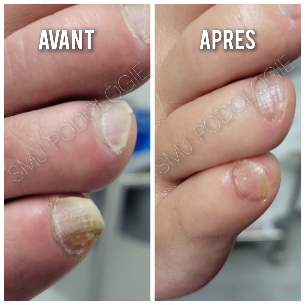 SMJ PODOLOGIE Soins de pieds à domicile | 359A Rang de la Rivière Sud-Ouest, Maskinongé, QC J0K 1N0, Canada | Phone: (514) 318-2050