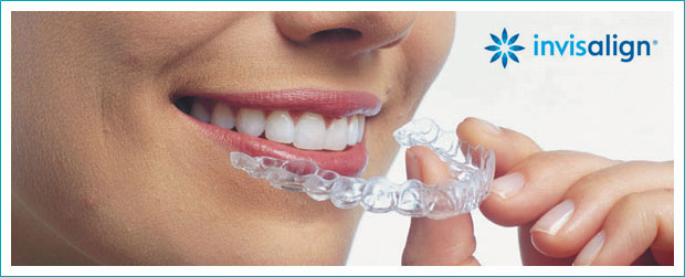 Sherwood Dental | 501 Krug St Unit #113, Kitchener, ON N2B 1L3, Canada | Phone: (519) 576-2170