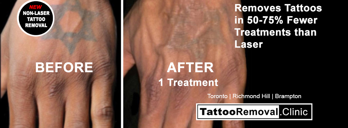 Laser Wellness & Trichology Centre | 9140 Leslie St #301, Richmond Hill, ON L4B 3L6, Canada | Phone: (647) 697-6450