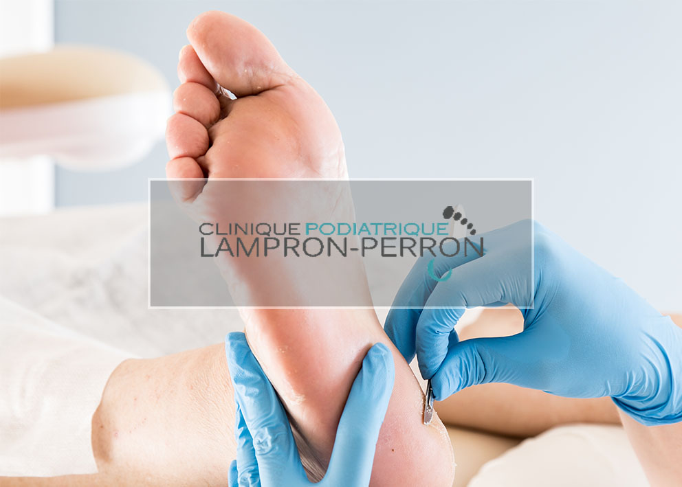 Podiatry Clinic Lampron-Perron | 66 QC-132 #220, Delson, QC J5B 0A1, Canada | Phone: (450) 845-7433