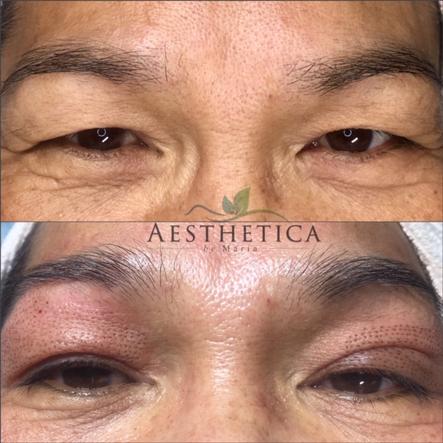 AESTHETICA MARIA / Phibrows Microblading and Medical Aesthetics  | 818 49 Ave SW, Calgary, AB T2S 1G9, Canada | Phone: (587) 434-7011